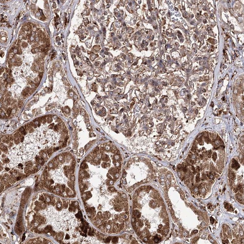 Anti-FANCL Antibody