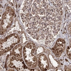 Anti-FANCL Antibody