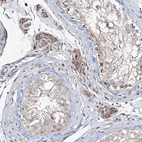 Immunohistochemical staining of human testis shows moderate cytoplasmic positivity in Leydig cells.