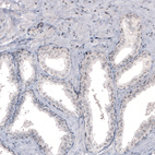 Immunohistochemical staining of human prostate shows strong nucleolar positivity in glandular cells.