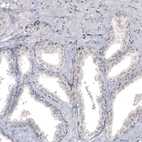 Immunohistochemical staining of human prostate shows strong nucleolar positivity in glandular cells.