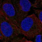 Immunofluorescent staining of human cell line U-2 OS shows localization to nuclear bodies & vesicles.