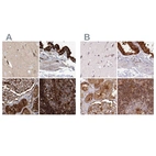 Anti-EML4 Antibody