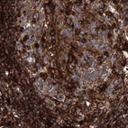 Immunohistochemical staining of human lymph node using Anti-EML4 antibody HPA036688.