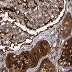 Immunohistochemical staining of human kidney using Anti-EML4 antibody HPA036688.