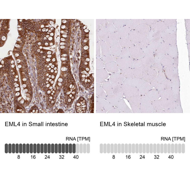 Anti-EML4 Antibody