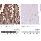Anti-EML4 Antibody