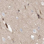 Immunohistochemical staining of human cerebral cortex using Anti-EML4 antibody HPA036688.