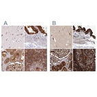 Immunohistochemical staining of human cerebral cortex, gallbladder, kidney and lymph node using Anti-EML4 antibody HPA036687 (A) shows similar protein distribution across tissues to independent antibody HPA036688 (B).