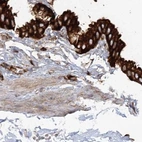 Immunohistochemical staining of human gallbladder using Anti-EML4 antibody HPA036688.
