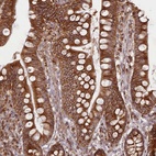 Immunohistochemical staining of human small intestine shows high expression.