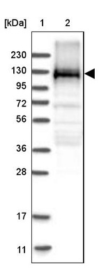 Lane 1: Marker [kDa] 230, 130, 95, 72, 56, 36, 28, 17, 11_br/_Lane 2: Human cell line RT-4