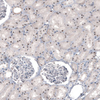 Immunohistochemical staining of human kidney shows strong nucleolar positivity in cells in tubules.