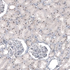 Immunohistochemical staining of human kidney shows strong nucleolar positivity in cells in tubules.
