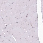 Immunohistochemical staining of human skeletal muscle shows low expression as expected.