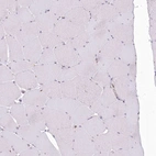 Immunohistochemical staining of human skeletal muscle shows low expression as expected.