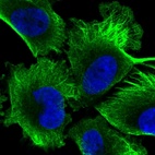 Immunofluorescent staining of human cell line U-251 MG shows localization to cytosol, intermediate filaments & microtubules.