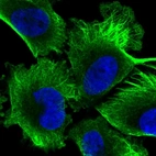 Immunofluorescent staining of human cell line U-251 MG shows localization to cytosol, intermediate filaments & microtubules.
