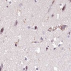 Immunohistochemical staining of human cerebral cortex using Anti-EML4 antibody HPA036687.