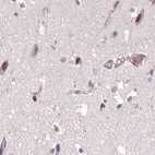 Immunohistochemical staining of human cerebral cortex using Anti-EML4 antibody HPA036687.