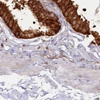 Immunohistochemical staining of human gallbladder using Anti-EML4 antibody HPA036687.