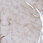 Immunohistochemical staining of human skeletal muscle shows very weak cytoplasmic positivity in myocytes.