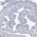 Immunohistochemical staining of human fallopian tube shows no positivity in glandular cells as expected.