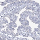 Immunohistochemical staining of human fallopian tube shows no positivity in glandular cells as expected.