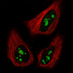 Immunofluorescence staining in HeLa cell line with Anti-MKI67IP monoclonal antibody, showing specific staining of nucleoli in green. Microtubule- and nuclear probes are visualized in red and blue respectively (where available).