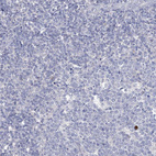 Immunohistochemical staining of human tonsil shows no positivity in non-germinal center cells as expected.