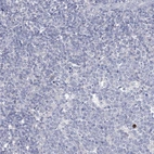 Immunohistochemical staining of human tonsil shows no positivity in non-germinal center cells as expected.