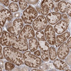 Anti-INPP1 Antibody