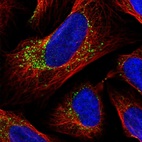 Immunofluorescent staining of human cell line U-2 OS shows localization to vesicles.