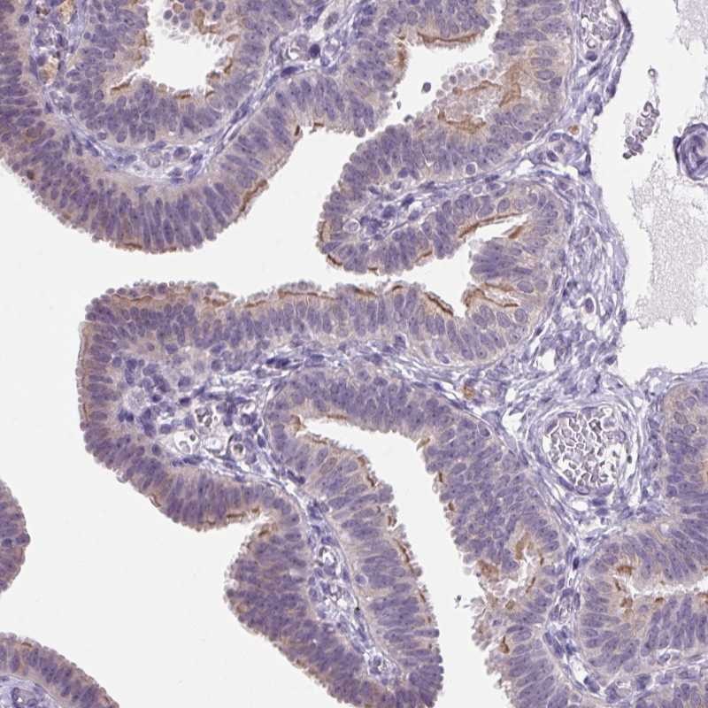 Anti-VWA3B Antibody