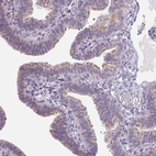 Anti-VWA3B Antibody