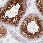 Immunohistochemical staining of human testis shows high expression.