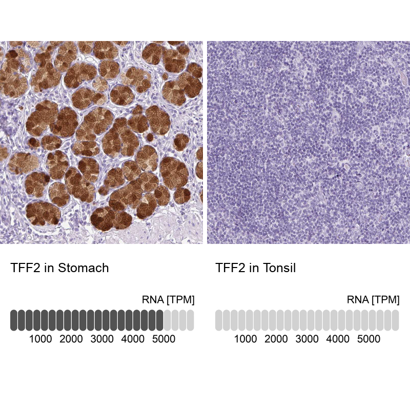 Anti-TFF2 Antibody