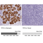 Anti-TFF2 Antibody