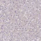Immunohistochemical staining of human liver shows low expression as expected.