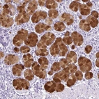 Immunohistochemical staining of human stomach shows strong membranous and cytoplasmic positivity in glandular cells.