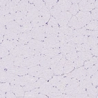 Immunohistochemical staining of human skeletal muscle shows no positivity in myocytes as expected.
