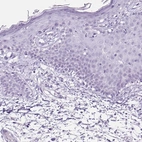 Immunohistochemical staining of human skin shows no positivity in squamous epithelial cells as expected.