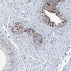 Immunohistochemical staining of human epididymis shows high expression.