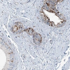 Immunohistochemical staining of human epididymis shows high expression.