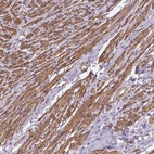 Immunohistochemical staining of human smooth muscle shows strong cytoplasmic positivity in myocytes.