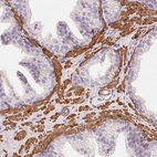 Immunohistochemical staining of human prostate shows strong cytoplasmic positivity in smooth muscle cells.