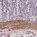 Immunohistochemical staining of human gastrointestinal shows strong cytoplasmic positivity in smooth muscle cells.