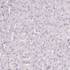 Immunohistochemical staining of human liver shows no positivity in hepatocytes as expected.