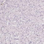 Immunohistochemical staining of human liver shows no positivity in hepatocytes as expected.