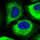 Immunofluorescent staining of human cell line HeLa shows localization to cytosol & actin filaments.